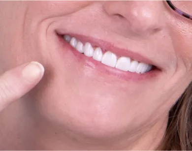 Patient in Tijuana smiling post root canal treatment