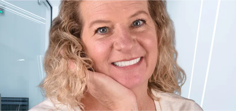  Happy patient smiling confidently after All-on-4 dental implant treatment.