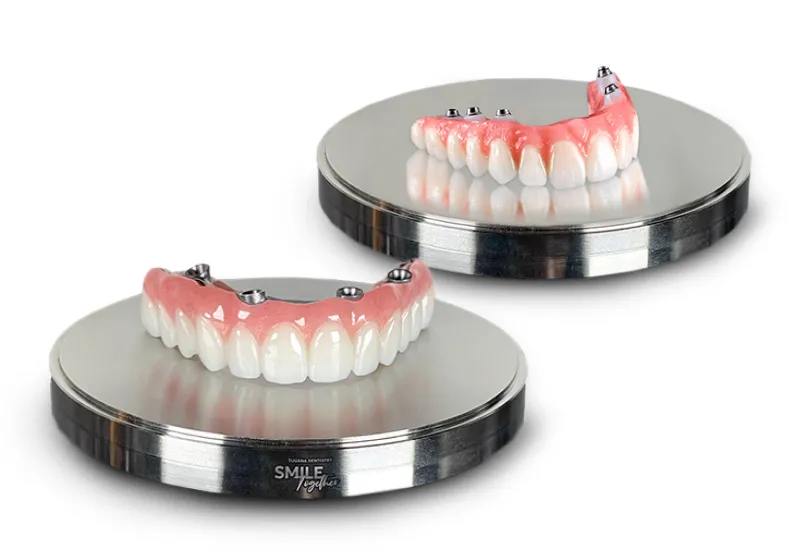 All on 4 Dental Implants