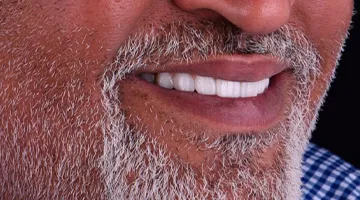 Smiling patient with all-on-4 dental implants