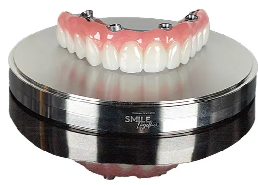 Prettau superstructure of all-on-4 dental implants