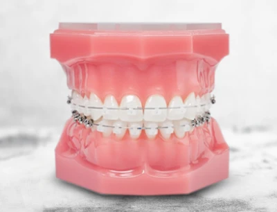 Patient showcasing a transformed smile after a smile makeover.