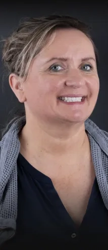 Patient with dental crowns in Tijuana. 