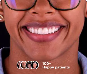 Patient's smile after dental veneers treatment in Cancun