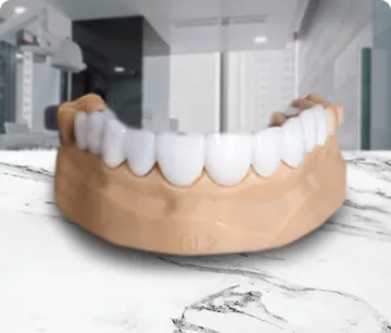 Dental veneers by Smile Together