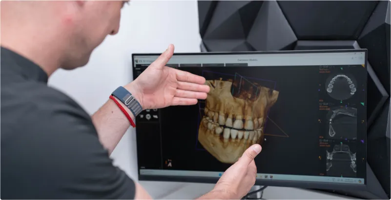 Doctor using a 3D scan to plan braces treatment in Tijuana, ensuring precise and effective results.