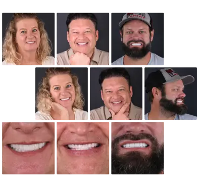 Gallery of smiles by Tijuana dentist.