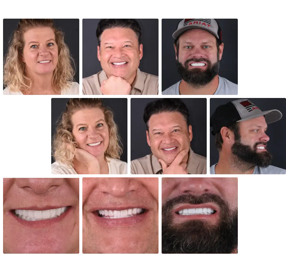 Gallery of smiles by Tijuana dentist.