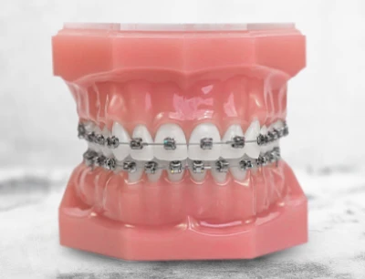 Patient smiling after dental crown procedure at Tijuana dentist.