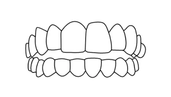 Braces treatment in Tijuana to improve their dental structure