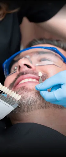 Step 2 of the veneer process in Tijuana: preparing the patient’s teeth for the application of veneers.